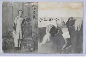 China Postcard - Chinese Woman with Lotus Bound Feet with and without Shoe - Picture 1 of 2