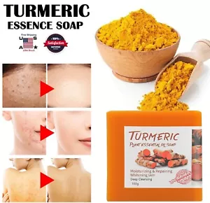 2× Tumeric Soap Skin Whitening Dark Spots lightening Acne Brightening Turmeric - Picture 1 of 12