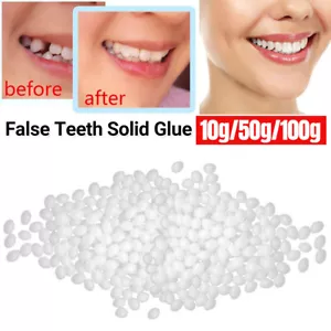 10~100g Tooth Repair Granules Temporary Kit Fitting Beads Reusable False Teeth - Picture 1 of 13