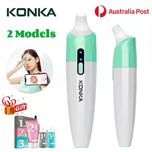 KONKA Visual Blackhead Suction APP LED Pimple Acne Cleanser Comedone Extractor - Picture 1 of 11
