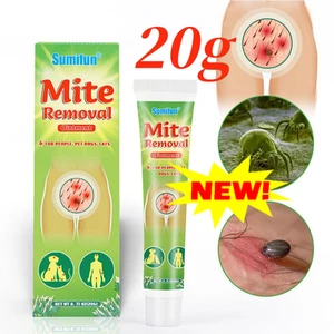 20g Milbenentfernungssalbe Anti-Juckreiz Krätze Tötet Kopfläuse -Pflegecreme - Bild 1 von 10