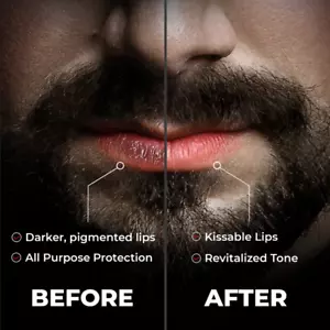 Best Lip Scrub For Dark & Dry Lips , Unisex , All SKin Suitable , 15g PAck Scrub - Picture 1 of 8