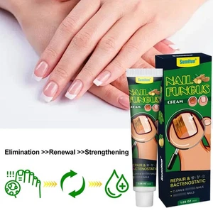 New Nail Fungus Cream Treat Onychomycosis Finger Toe Paronychia Ointment V7K0 - Picture 1 of 12