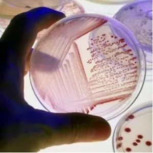 5g Laboratory Grade Nutrient Agar kit makes 12 Petri dishs Science Fair FreeShip - Picture 1 of 1