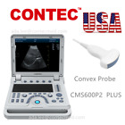 CONTEC high resolution B-Ultrasound Convex probe PW mode pseudo-color function