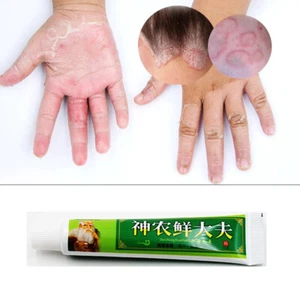 Chinese Medicine Herbal Anti-Bacteria Cream Anti-Itch Ointment - Picture 1 of 12