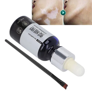Vitiligo Covering Liquid Waterproof Makeup Vitiligo Concealer Cosmetics For ZZ1 - Picture 1 of 12