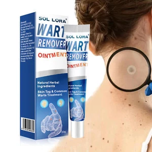 Common Wart Remover Skin Tags Remover Ointment Natural Wart Removal Skin - Picture 1 of 9