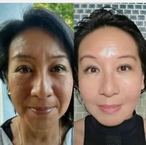 Facial Cleansing Anti-aging Firming Skin renewal Youthful Pore & Wrinkle Reducer - Picture 1 of 24