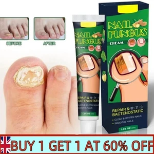New Nail Fungus Cream Treat Onychomycosis Finger Toe Paronychia Ointment ~ - Picture 1 of 9