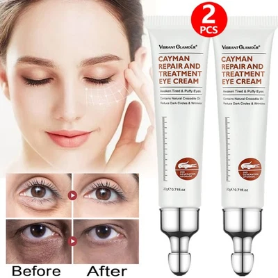 NEW 2PCS Eye Cream Remove Eye Bags / Dark Circles / Eye Wrinkles Anti-Aging Tool - Image 1 of 4
