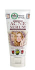 Hollywood Style Face Skin Oil Control Acne Serum 5.3 oz.75541