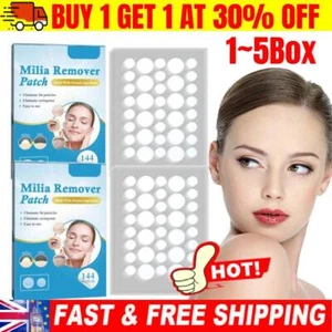 Milia Remover Patches For Milia Spot Wart Oil Bumps Treatment Skin 1-5box - Picture 1 of 13