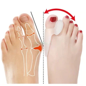 2 PCS New Toe Thumb Straightener Corrector Silicone Hallux Valgus Braces - Picture 1 of 8
