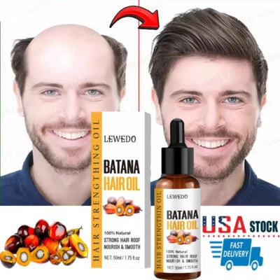 Natural Batana Oil Serum Anti-Loss Hair Scalp Care Hair Growth Dense Regrowth - Image 1 of 4