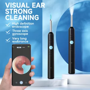 Wireless Smart Ear Cleaner Ear Wax Remover Camera EarPick LED Scoop Endoscope HD - Picture 1 of 20