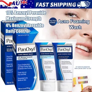Acne Foaming Wash for Face & Body 4% 10% Benzoyl Peroxide Acne Foaming Cleanser - Picture 1 of 20