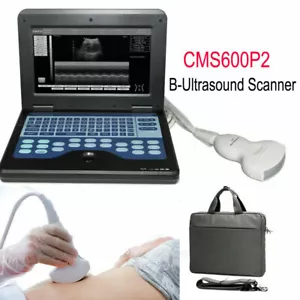 Digital Portable Ultrasound Machine Laptop Scanner with 3.5Mhz Convex Probe CE - Picture 1 of 10