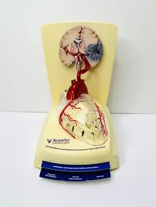Xarelto Medical Advertising 3D Human Heart/brain Display Model DRUG REP - Picture 1 of 7