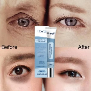 15ml Eye Serum for Rapid Reduces Under-Eye Bags, Wrinkles, Dark Circles, Lifting - Picture 1 of 32
