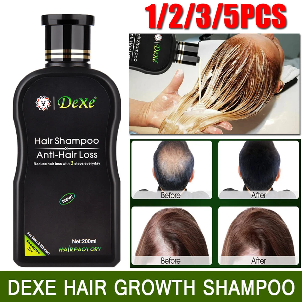 Hair Growth Shampoo Hair Thickening Shampoo Hair Loss Treatment for Men & Women - Image 1 of 4