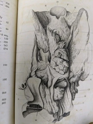 DUBLIN HOSPITAL REPORTS 1818 Illustrated Antique Medical Book Vol II, 5 Plates - image 1 of 4