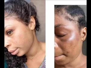 Magical Extrême Whitening Face Soap No Need Face Cream 💯 Result Super Effective - Picture 1 of 1