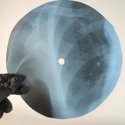 DAVID BOWIE LOVE ME TILL TUESDA X-Ray USSR Record Roentgen Bone Ribs Music Vinyl - Image 1 of 2