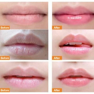 Intensive Lippenreparatur Behandlungsmaske Balsam Peeling Relief für sehr trockene rissige Lippen - Bild 1 von 12