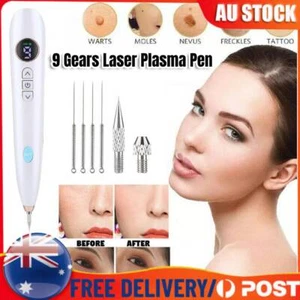 9 Level Laser Plasma Pen Mole Removal Dark Spot Remover Skin Wart Tag Tattoo AUS - Picture 1 of 16