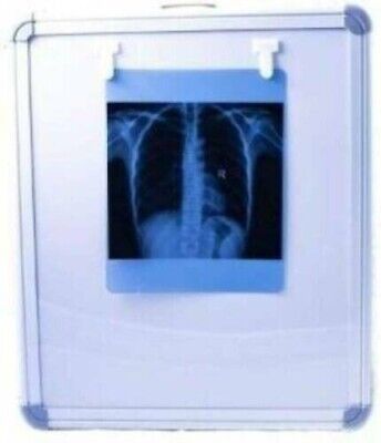 Led X Ray 1714 Viewer Illumination With High Brightness With Free Shipping • 116$