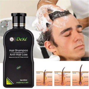 Hair Growth Shampoo, Anti Hair Loss Treatment, Natural Stimulates Hair Regrowth - Picture 1 of 23