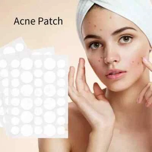 24x Acne Plasters Patches Tea Tree Blemish Skin Tag Removal Spot Acne Control - Picture 1 of 20