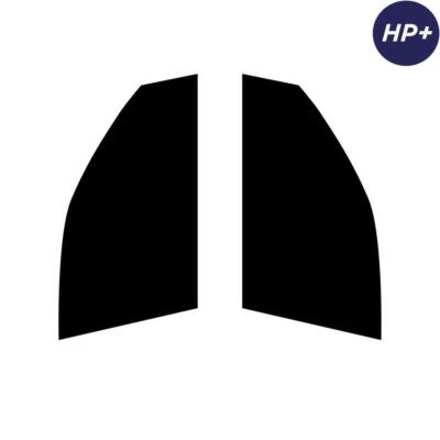 For Hyundai Amica 5-door Hatchback 2000-03 Carbon Pre Cut Window Tint Front HP+ - Image 1 of 4