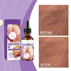 30ml Butt Enhancement Essential Oil Hip Lift Firming Carry But tock Oil Hip Care - Picture 1 of 11