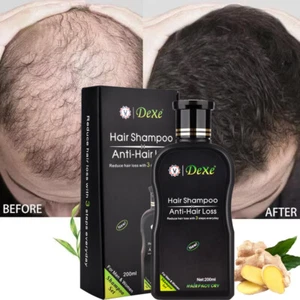 200ml Dexe Fast Hair Growth Shampoo Anti Hair Loss Hair Thickening For Women Men - Picture 1 of 29
