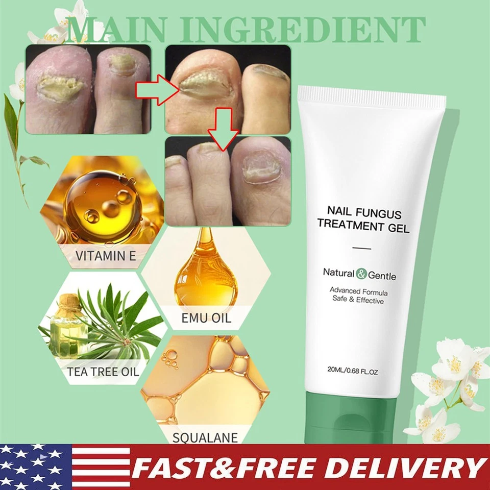 Nutraboost гель для лечения грибка ногтей, натуральный укрепляющий гель для восстановления ногтей - Изображение 1 из 4