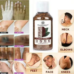 Coffee Scrub For Face Body Neck Knees Blackhead Remover Tan Dirt Removal 75 g - Picture 1 of 8