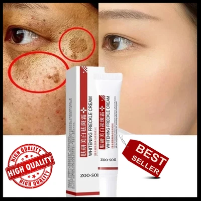 Crema blanqueadora eficaz para eliminar manchas oscuras crema para eliminar melanina melasma Foto 1 de 4