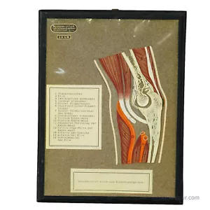 Antigua ayuda visual científica - corte de hueso del codo humano - Imagen 1 de 6