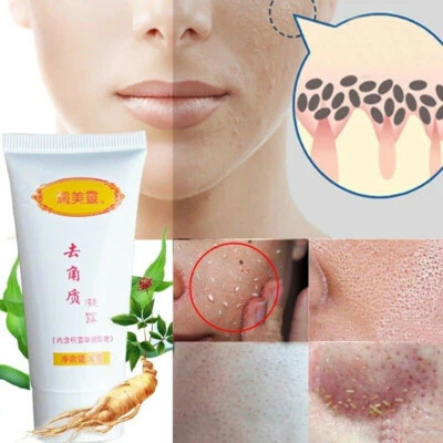 30g Peeling Facial Scrub Cream Gel Exfoliating Whitening Dead Skin Remover . - Image 1 of 4