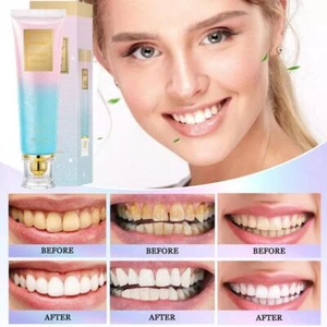 Niacinamide Whitening Toothpaste Niacinamide Intensive Whiteni丨UK - Picture 1 of 10