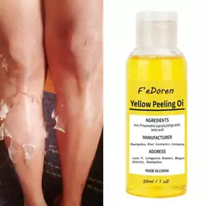 Yellow Peeling Oil Exfoliating Super Strength Lightening Dark Skin for Body - Picture 1 of 10