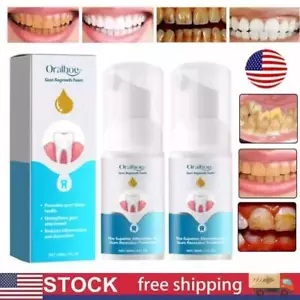 ORALHOE Gum Regrowth Foam 30ml Treatment Natural For Oral Care Restoration US - Picture 1 of 13