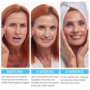 Retinol Cream for Face with Hyaluronic Acid, Anti Aging Wrinkle Cream for Wom... - Picture 1 of 12