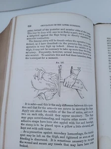 Antique 1866 Eclectic Surgeries RARE Over 100 Engravings Medical Book MD Surgeon - Picture 1 of 23