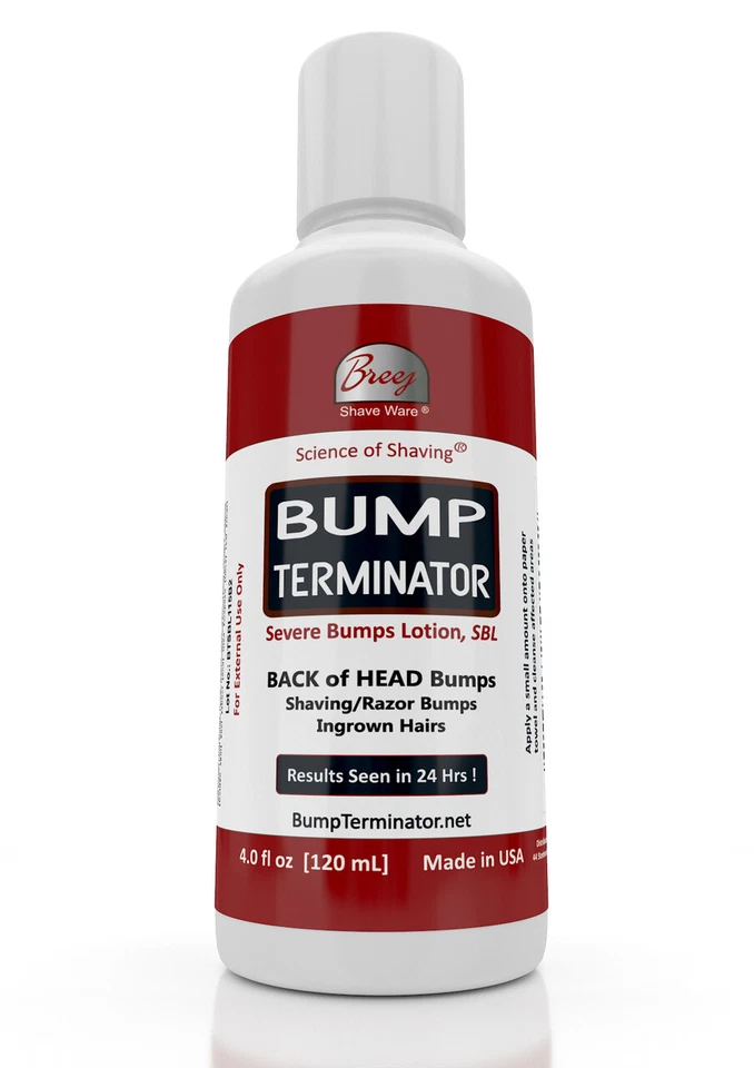 Loção Bump Terminator Severe Bumps - Tratamento de cabelo encravado para barbear - Unissex - Imagem 1 de 4