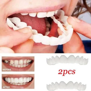 1 set faccette dentali superiori inferiori a scatto denti finti copertura denti finti - Foto 1 di 7