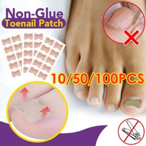 Glue Free Toenail Patch High Quality Toe Patch Ingrown Nail Correction Stickers! - Picture 1 of 15