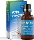 Evagloss Natural Wart Remover, Maximum Strength, Painlessly Removes Results